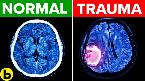 Early Childhood Experiences May Lead To Irreversible Changes In The Brain: STUDY