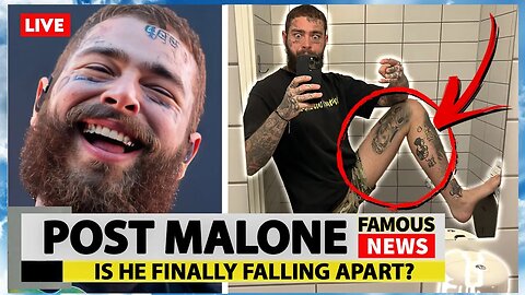 Fans Are Worried About Post Malone's Weight Loss | Famous News