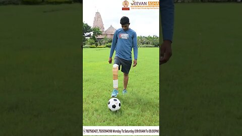 Omkar lost his right leg in a accident Jeevan Asha Hospital provided free of cost modular prosthesis