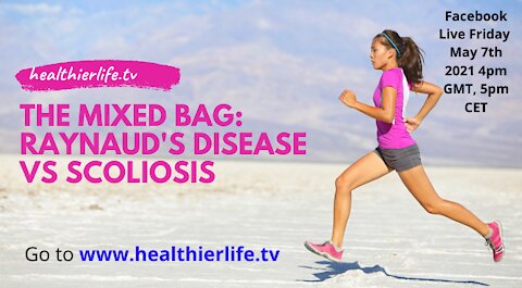 The Mixed Bag: Raynaud's Disease Vs Scoliosis