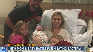 Mom and newborn battle flesh-eating bacteria