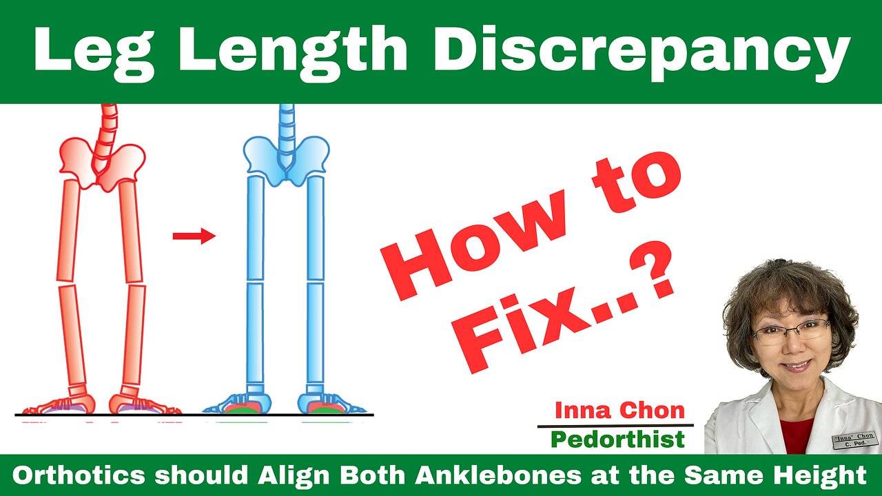 Leg Length Discrepancy, How to Fix.