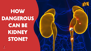 What Causes Kidney Stone?
