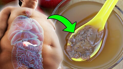How To Use Apple Cider Vinegar To Lose Weight And Reduce Belly Fat