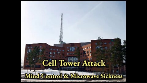 Cell Tower Attack Mind Control & Microwave Sickness, Tinnitus, Insomnia, Fatigue