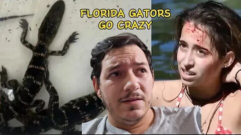 Woman bit on head by alligator and gators in a bathtub???