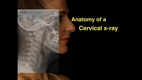 Anatomy of a Cervical x-ray