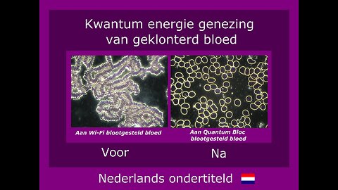 Spectaculaire verbetering van het bloedbeeld door kwantum energie technologie