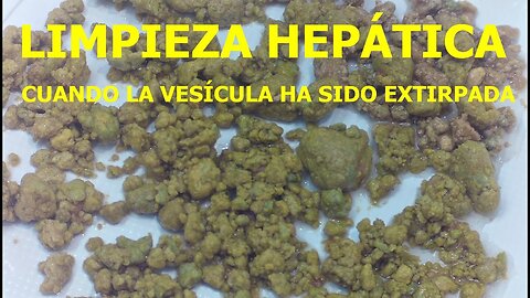 LIMPIEZA HEPATICA SIN VESICULA BILIAR PORQUE HA SIDO EXTIRPADA O CON PROBLEMAS EN VIAS BILIARES