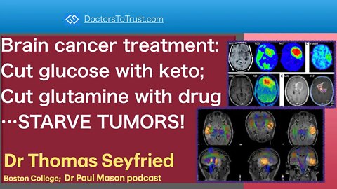 TOM SEYFRIED 6 | Brain cancer treatment: Cut glucose with keto; & glutamine with drug…STARVE TUMORS!