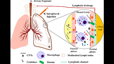 Graphene Oxide + Carbon NanoTubes in Vaccines Cause Lung Injury Like Asbestos? (NurembergTrials.net)