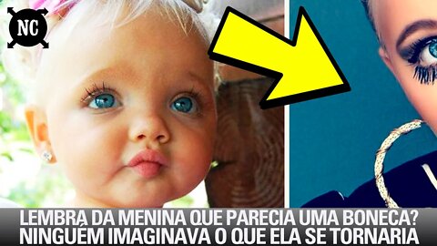 Lembra Da Menina Que Parecia Uma Boneca? Ninguém Imaginava O Que Ela Se Tornaria