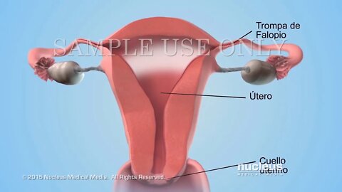 Análisis de semen cantidad de esperma