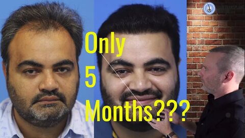 Is this the best FUE hair transplant clinic in India ?