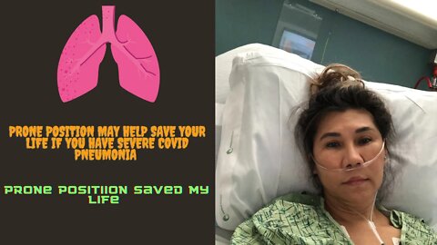 Covid Pneumonia - Prone straight between 16-20 hours saved my life !!