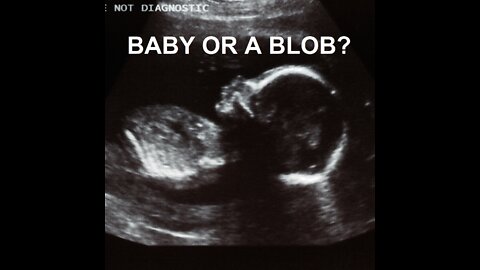IS IT A BLOB OR A BABY?