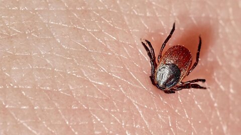 What Happens to Your Body When You're Bitten by a Tick?