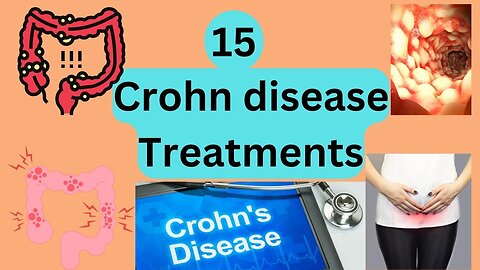 15 Crohn's disease treatments