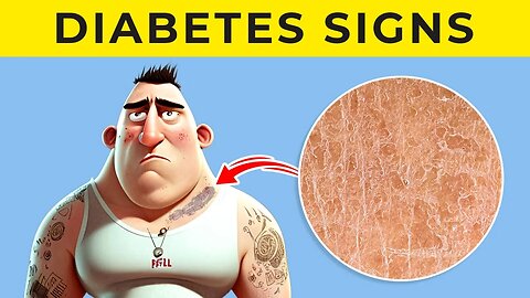 7 MAJOR Signs And Symptoms Of Diabetes | HOW To Detect!