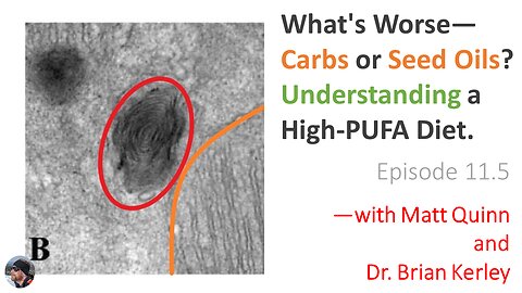 Ep. 12: Study: What's Worse—Carbs or Seed Oils? Understanding a High-PUFA Diet