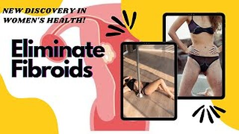 Avoid Fibroids Forever | New Test Predicts Whether Women Will Develop Fibroids