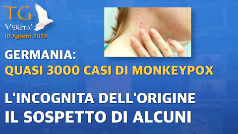 TG Verità - 10 Agosto 2022 - Monkeypox virus in Germania quasi 3000 casi. Quale può essere la causa?