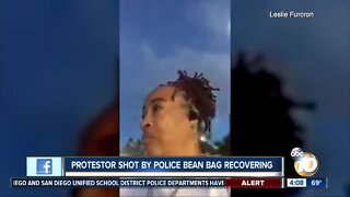 Protestor shot by police bean bag recovering