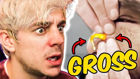 Reacting to the Grossest Pimple Popping Videos - Best Pimple Popping Video #3