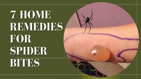 7 Home Remedies For Spider Bites