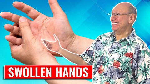 Puffy Hands: Acupressure for Swelling Relief