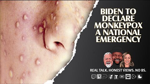 Biden To Declare Monkeypox A Nationwide Health Emergency