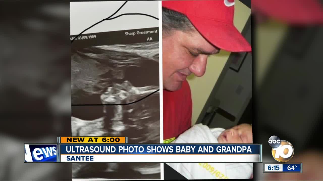 Ultrasound photo surprises Santee mom