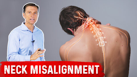 Chronic Neck Misalignment Does Not Come From the Neck