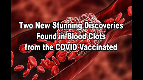 Two New Stunning Discoveries Found in Blood Clots from the COVID Vaccinated - Dr. Jane Ruby