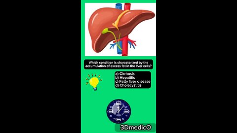 MCQs medical part liver #medical #mcqs #liver #3Dmedico