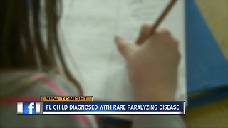 Florida hospital confirms first case of paralyzing polio-like disease found among children in state