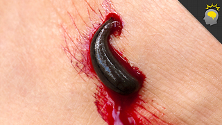 Stuff to Blow Your Mind: It's a Leech-Eat-Worm World - Science on the Web