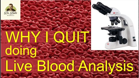 Why I QUIT Doing Live Blood Analysis