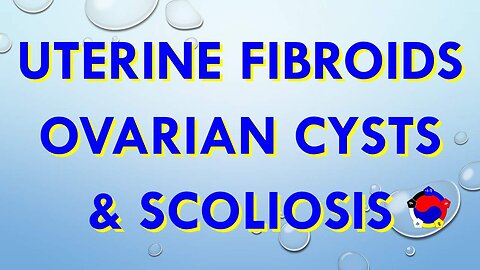 Uterine Fibroids, Ovarian Cysts & Scoliosis Testimonial