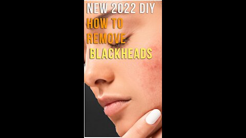 New 2022 DIY To Remove Blackheads