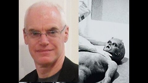 Alien Autopsy and Anthony Peake