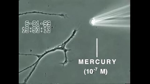 How Mercury Causes Brain Neuron Damage (Uni. of Calgary)