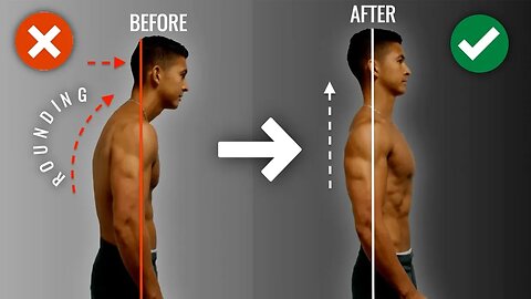 How To Fix Rounded Shoulders FAST (10 Minute Science-Based Corrective Routine)