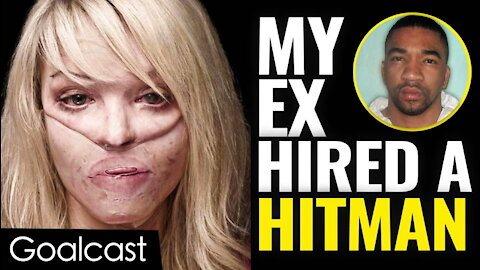 My Facebook Stalker Threw Acid In My Face | Katie Piper | Goalcast