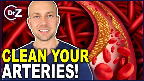 Top 5 Foods That CLEAN OUT Your Arteries