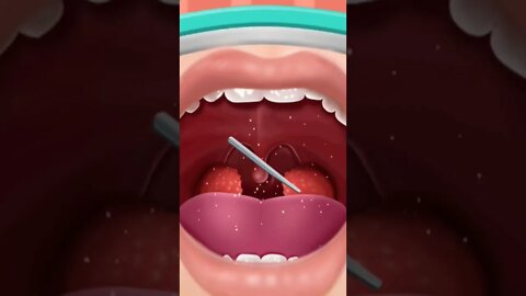 Removal of tonsils Part #2 #shorts #doctor #games