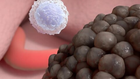 ¿Qué es la Inmuno-Oncología?