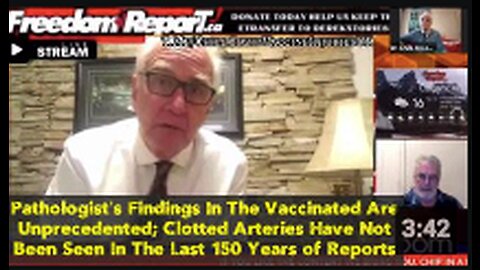 Pathologist’s Findings In The Vaccinated Are Unprecedented; Clotted Arteries Have Not Been Seen