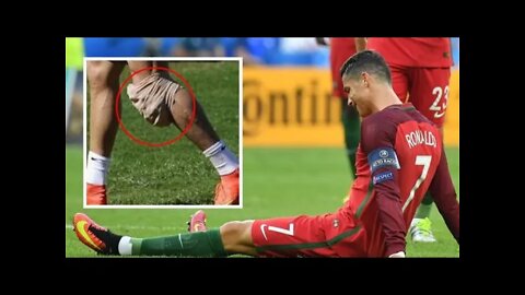 Cristiano Ronaldo's toughest injuries cr7