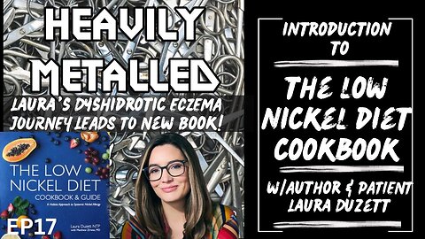 EP17 - Laura Duzett - The Low-Nickel Diet Cookbook & Laura's Dyshidrotic Eczema Story